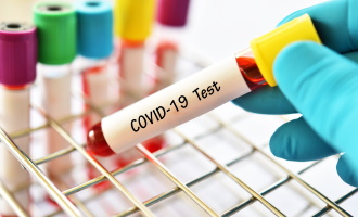 Testování „COVID-19“ pro firmy